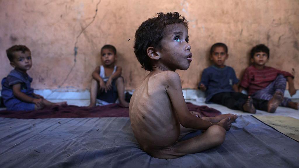 Yazan, un ni&ntilde;o palestino de 2 a&ntilde;os que sufre desnutrici&oacute;n, est&aacute; sentado junto a sus hermanos en la vivienda familiar da&ntilde;ada, situada en el campo de refugiados de al Shati