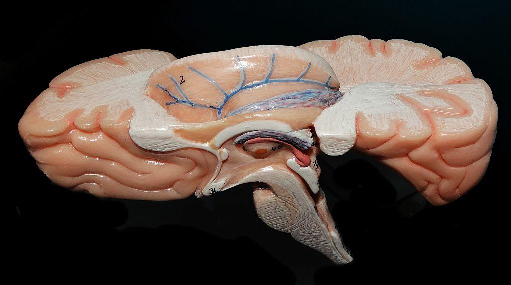Un modelo de cerebro sobre un fondo negro.  Las partes rosas del cerebro tienen l&iacute;neas; en el centro hay l&iacute;neas negras