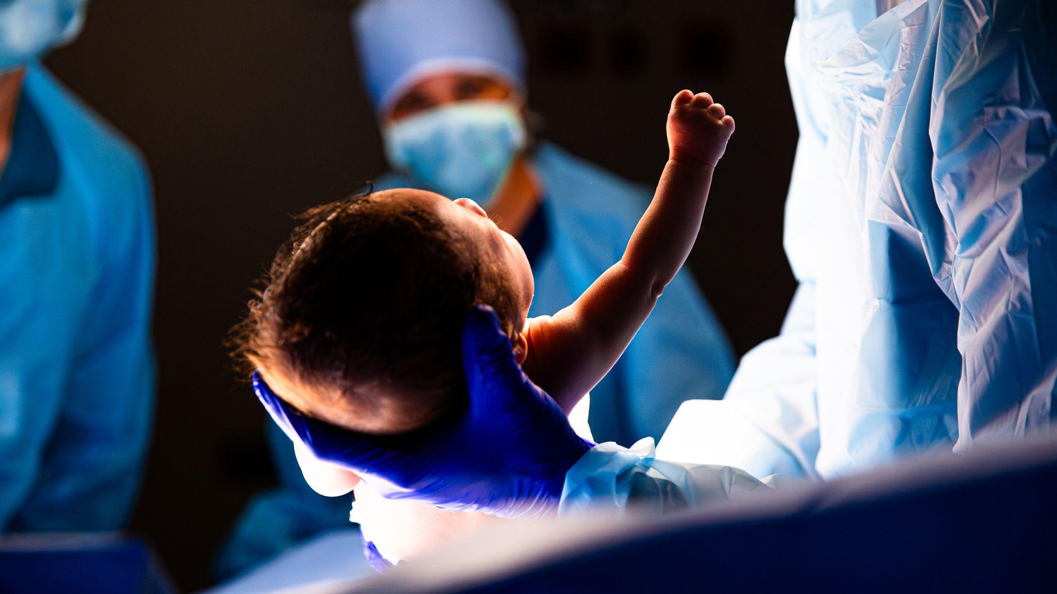 Personal médico con equipos de protección individual (EPI) atiende a un bebé recién nacido.