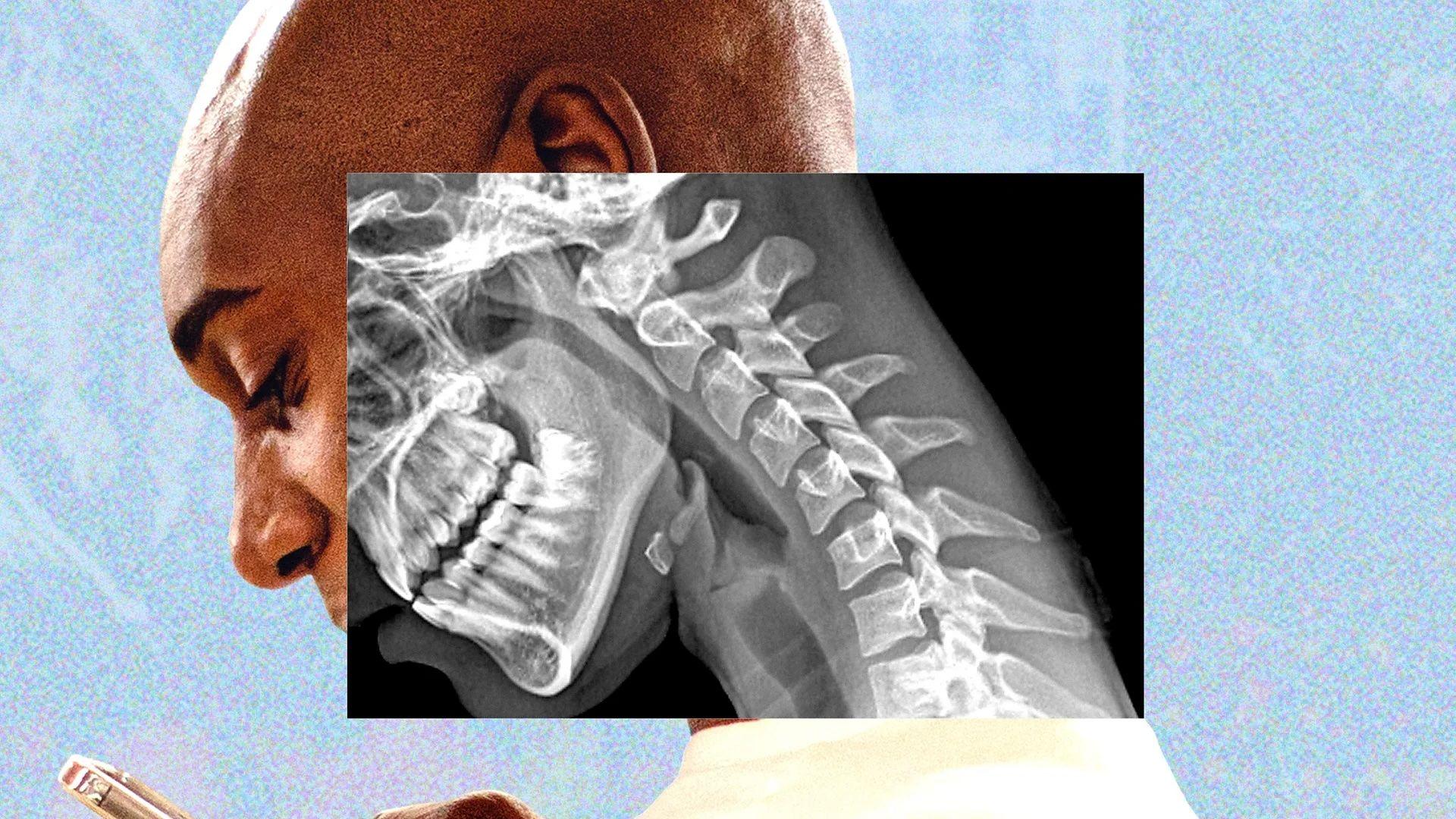 Un montaje en el que se ve a un hombre con la mirada hacia abajo, enfocado en la pantalla de su tel&eacute;fono. Parte de su rostro se ve cono si fuera una radiograf&iacute;a en la que se ve su cuello estirado hacia adelante.