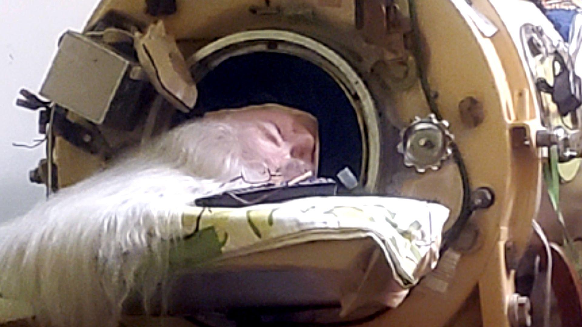 La mujer que vivió 73 años metida varias horas al día en un pulmón de acero que le permitía respirar