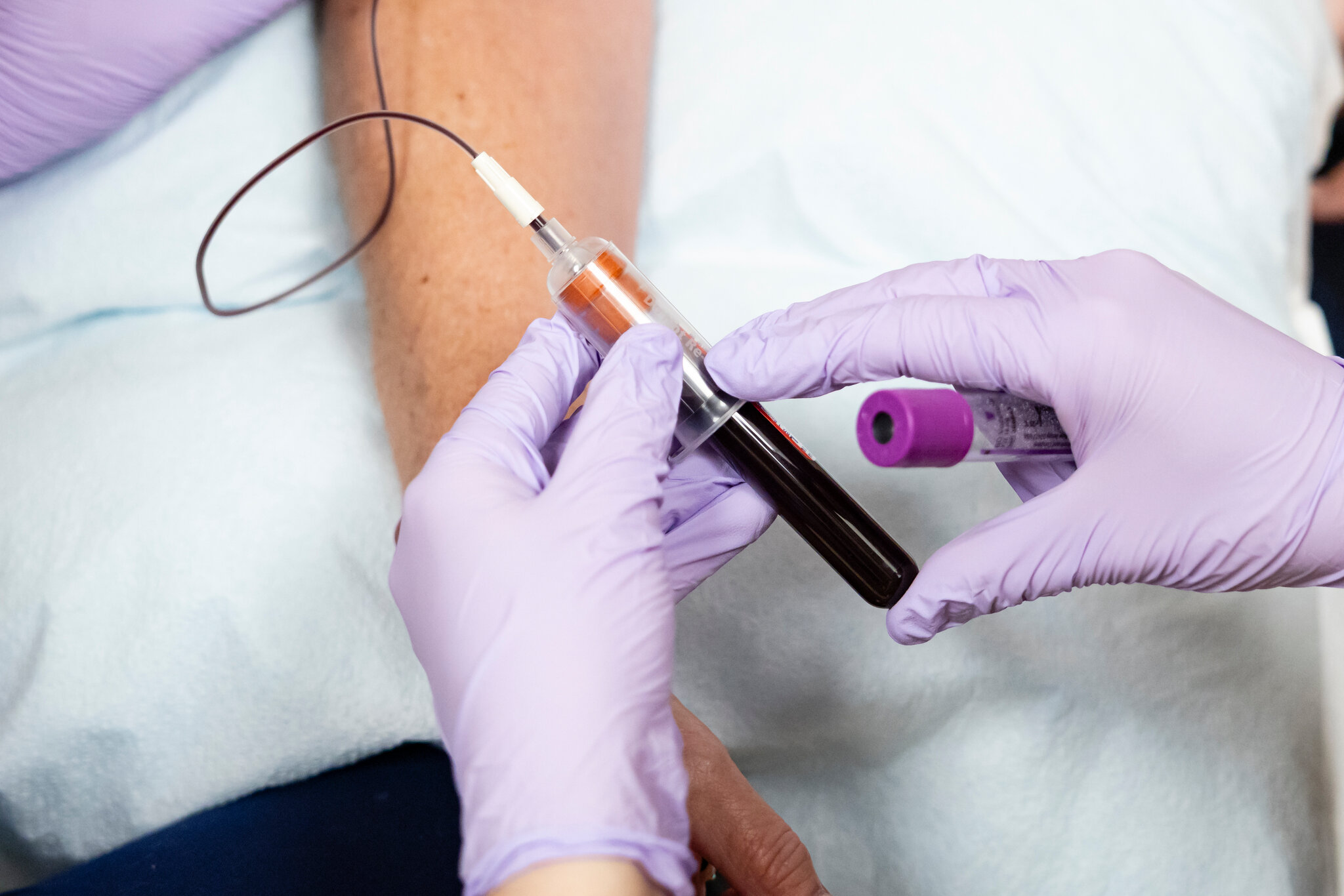 Lo que debes saber sobre la nueva y potente píldora para el colesterol