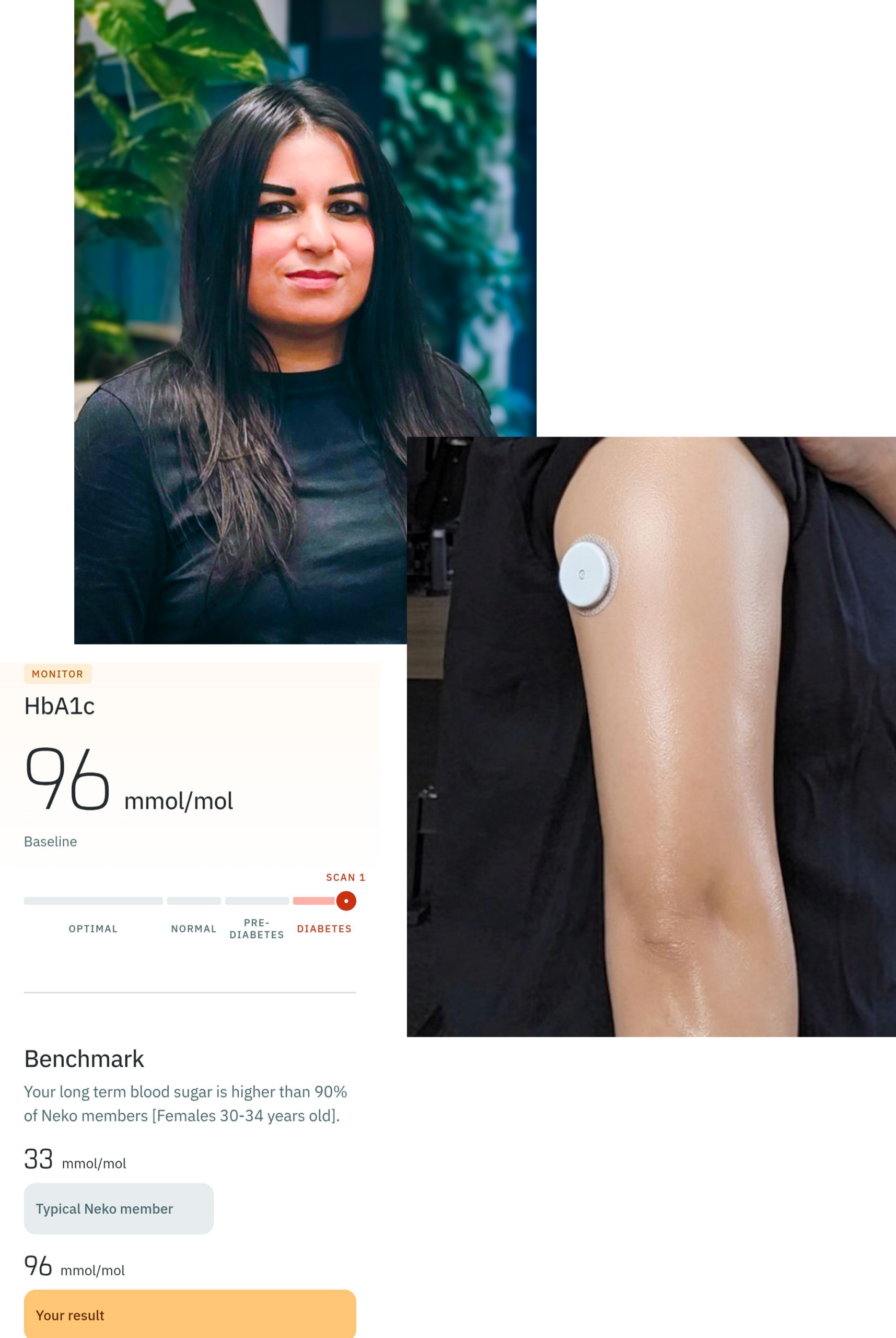 Un retrato de Mehvish, junto a una imagen que muestra los resultados de sus niveles de azúcar en la sangre, y otra que muestra su brazo con detectores de glucosa pegados 