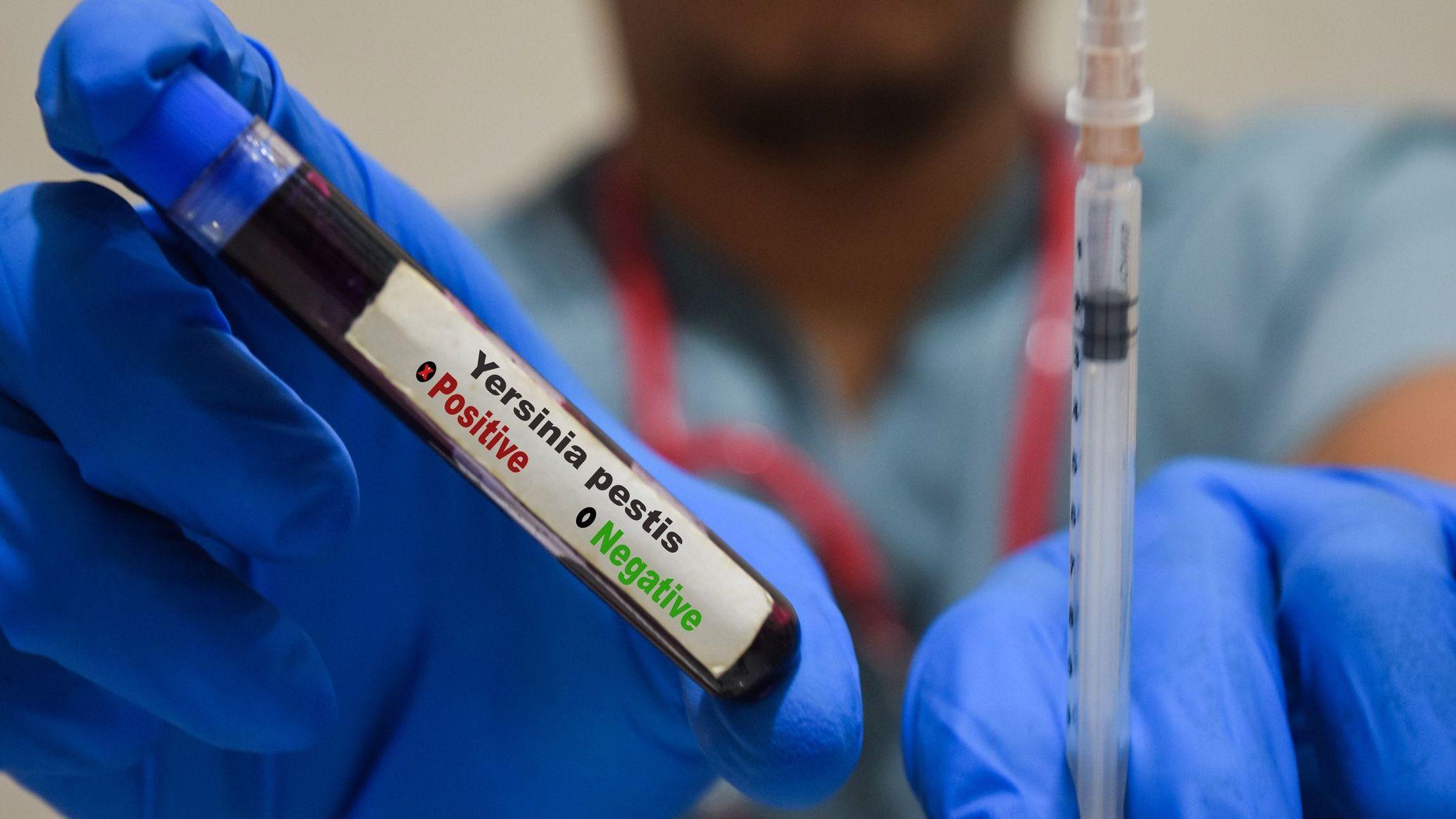 Qué es y cómo se propaga la peste neumónica que se estudia en el laboratorio de Siberia en el que falleció una trabajadora