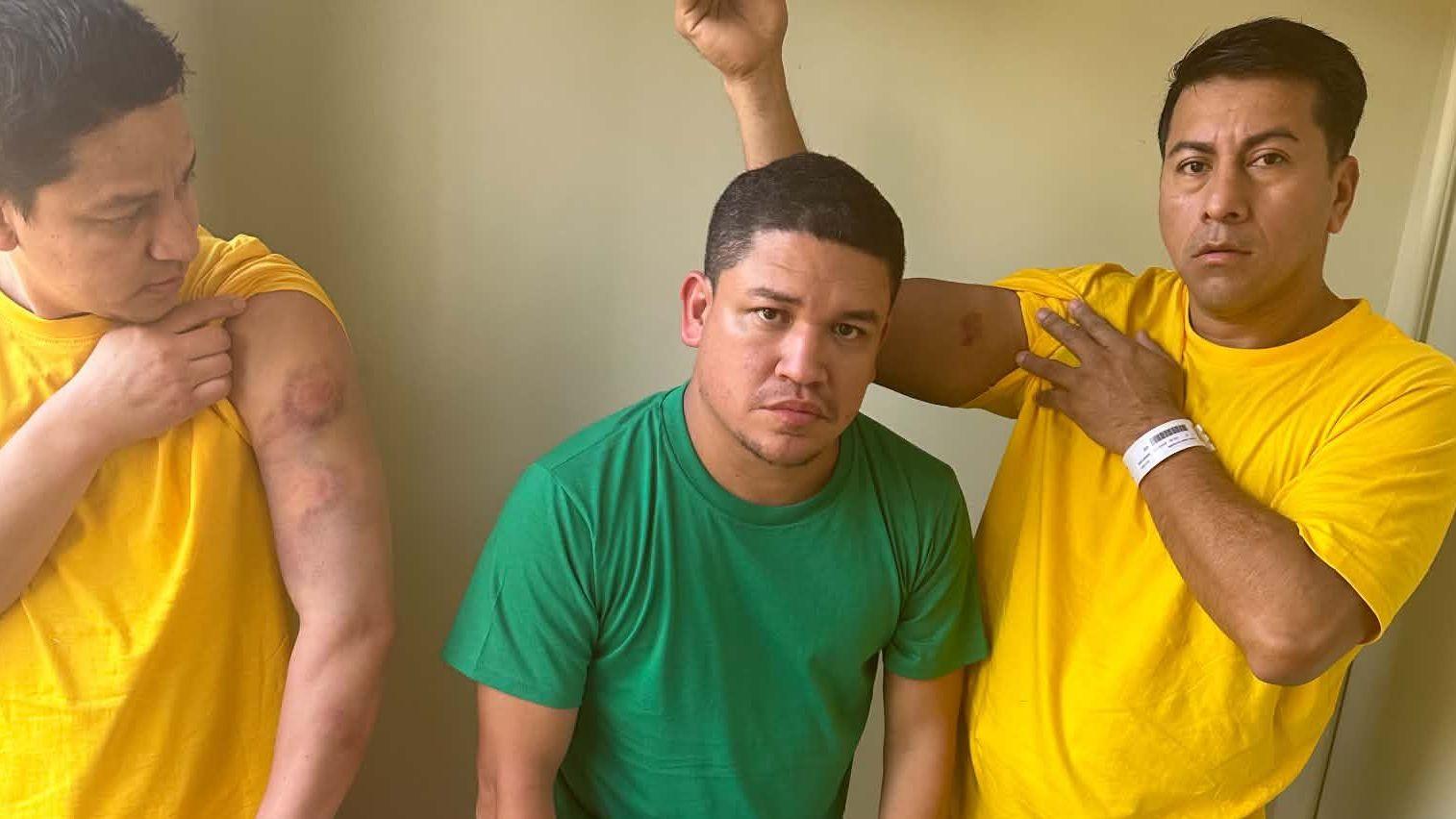  Isaac Cruz, Luis Mendoza y Kenis López muestran los hematomas que según ellos les habrían causado los proyectiles con armas menos letales disparados por agentes de ICE.