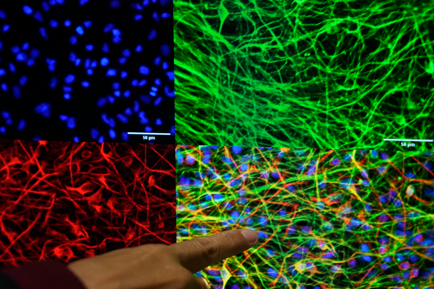 Una muestra de neuronas en diferentes colores sobre una pantalla.