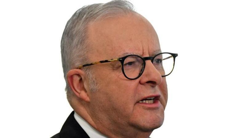 Anthony Albanese